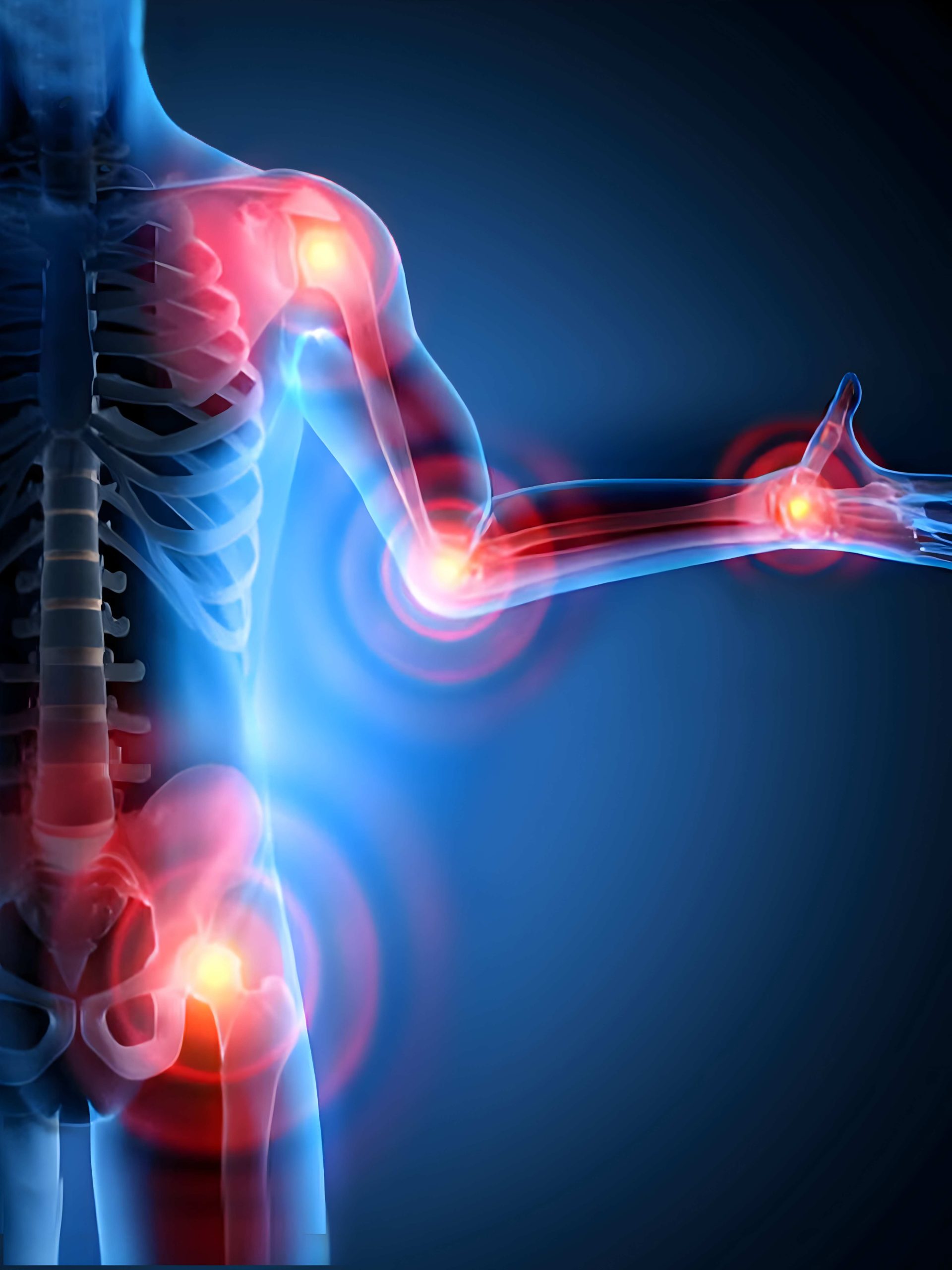 Rheumatology