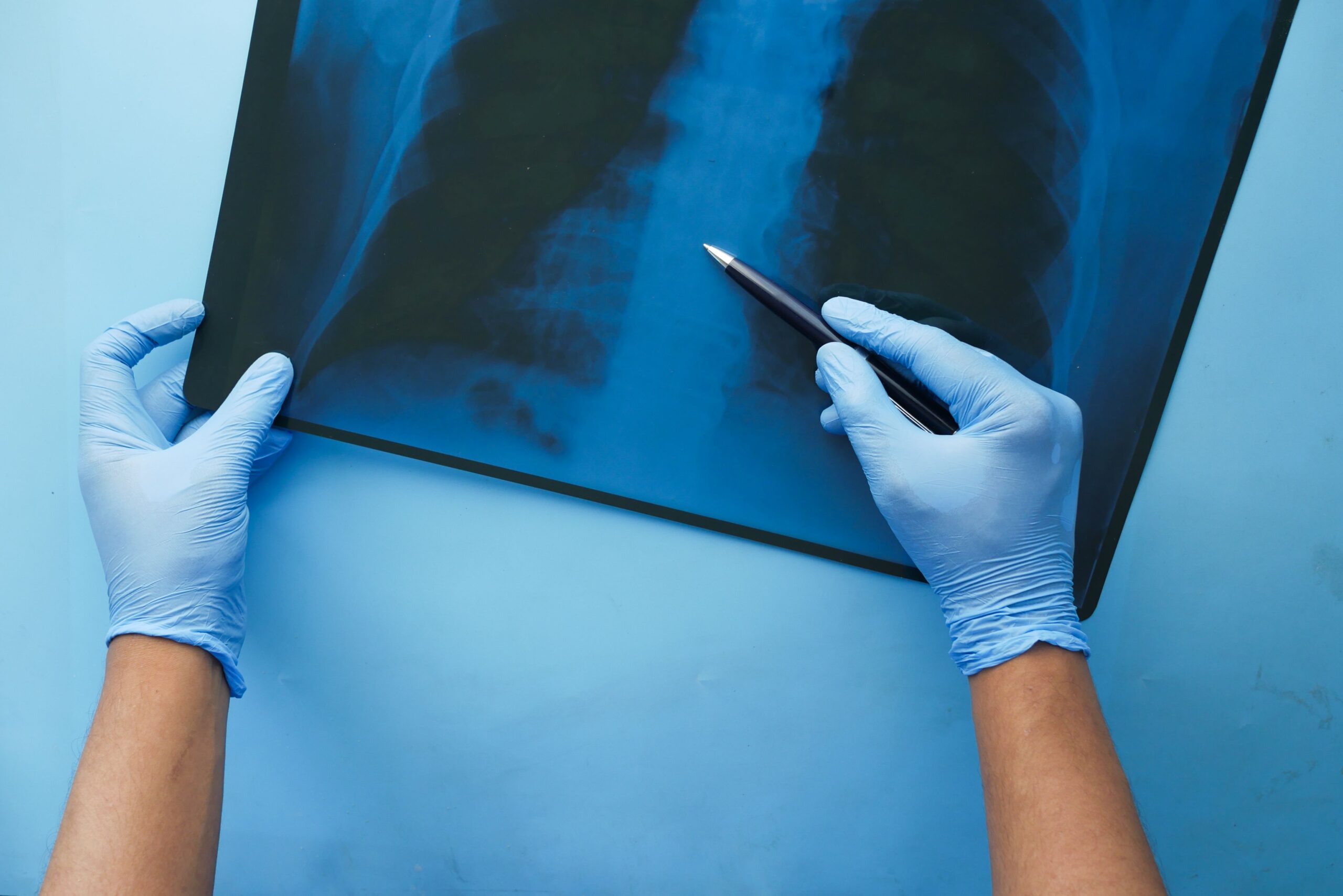 What Does a Pulmonology Doctor Do