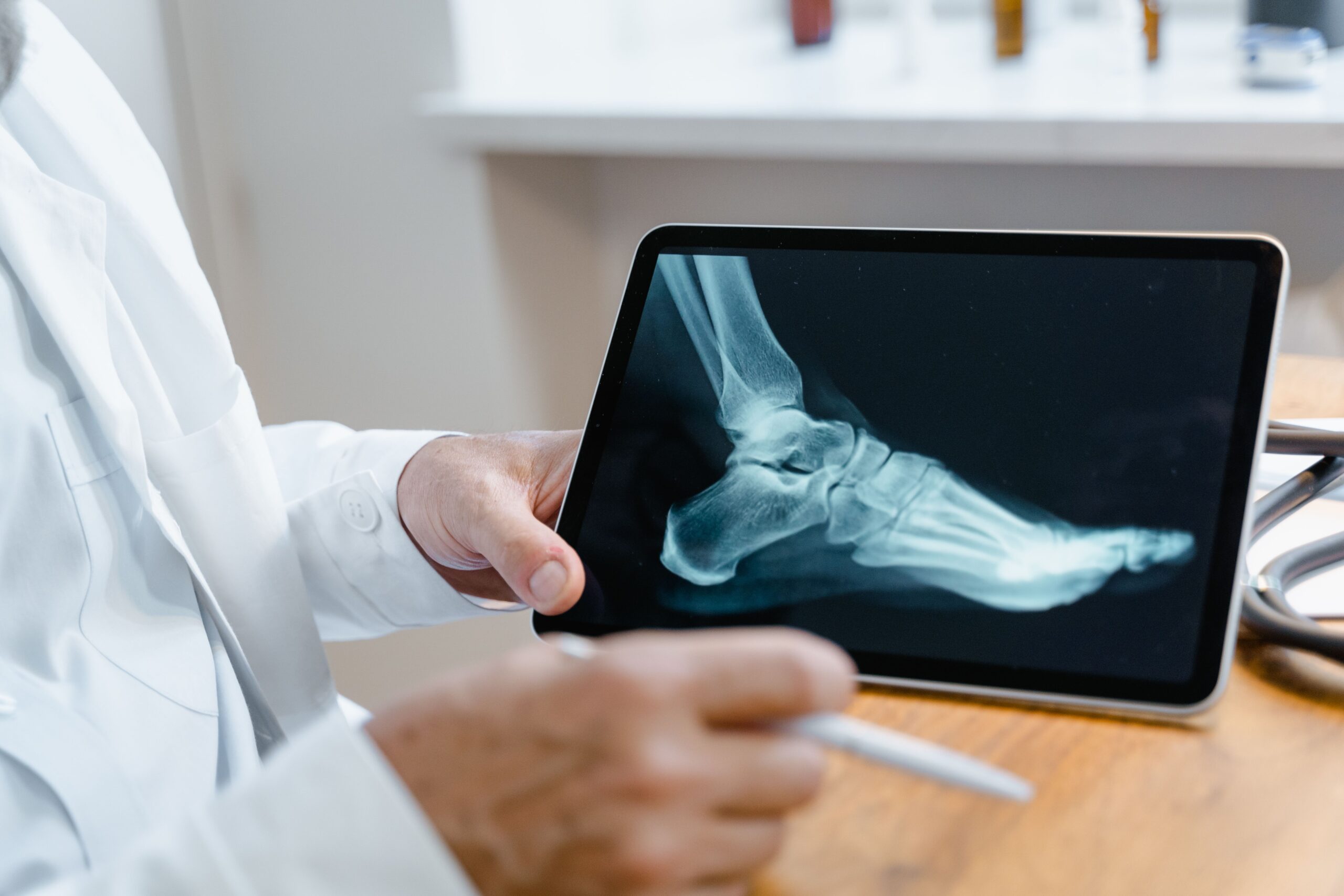 Rheumatologist for rheumatoid arthritis